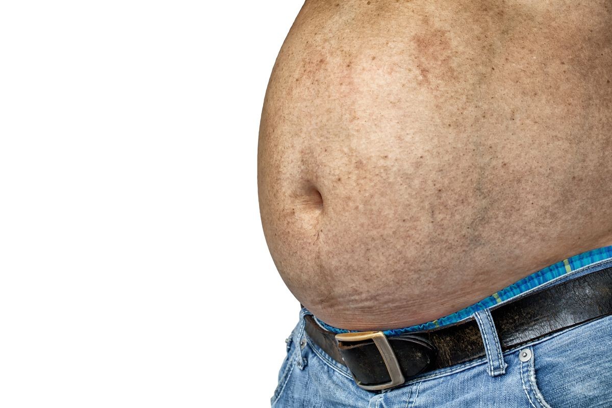 The Dangers of Belly Fat., Obese Man in Jeans Show His Belly Fat.